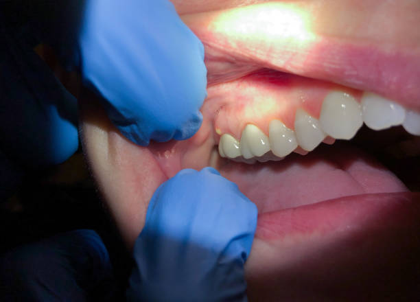 Best Urgent Dental Care in Mount Pleasant, TX
