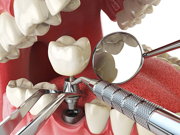 Best Emergency Orthodontic Repairs in Mount Pleasant, TX